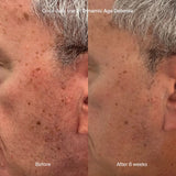 DYNAMIC AGE DEFENSE